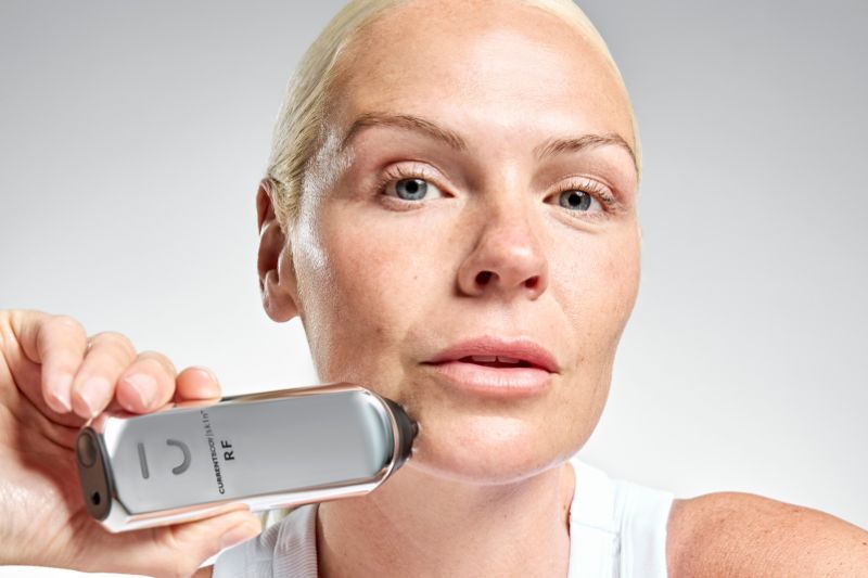 La radiofrequenza da fare a casa: tutto quello che c'è da sapere