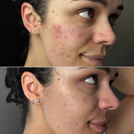 Red light LED therapy before and after: images and results