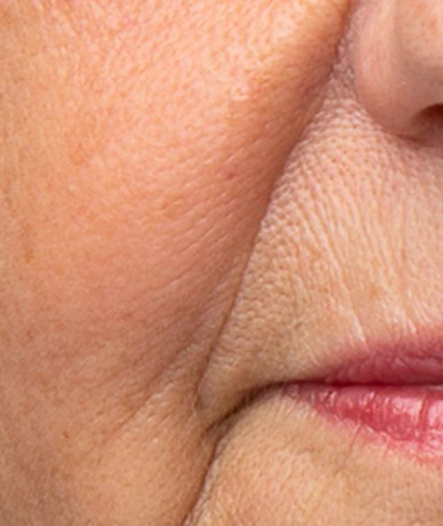 Anti-ageing Products