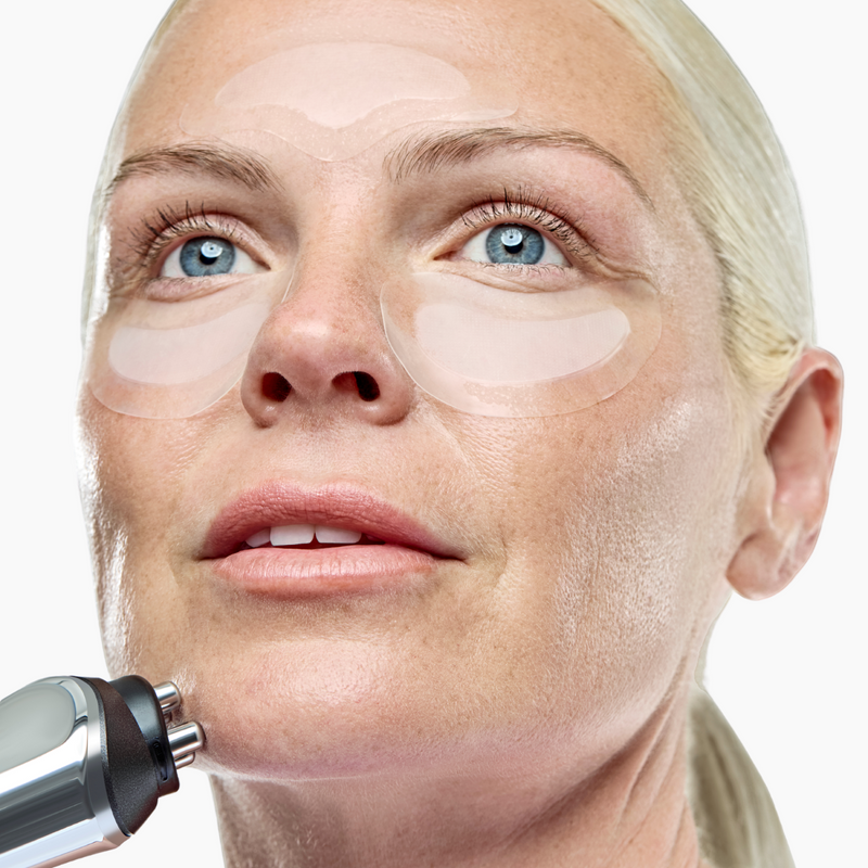 RF Microneedling Treatment