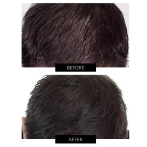 Cuffia Laser CapillusPro per la crescita dei capelli