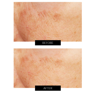 Acid Peel al Limone Caviale con Acido Glicolico Lancer (50ml)