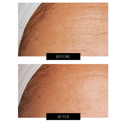 Lancer Skincare The Method: Detergente Anti-Imperfezioni (120ml)