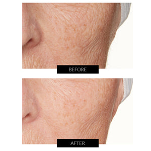 Lancer Skincare The Method: Detergente Anti-Imperfezioni (120ml)