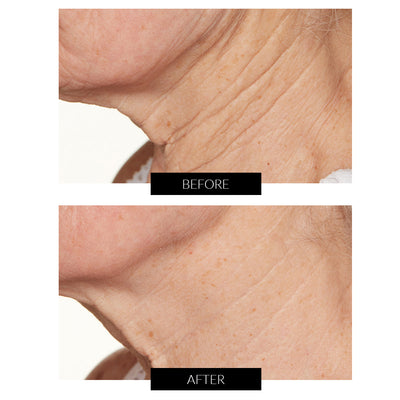 Lancer Skincare Trattamento Notte Intensivo con Hylaplex® e Olio di Marula (50ml)