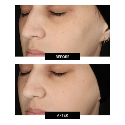 Maschera in Silicone  FAQ™ 202