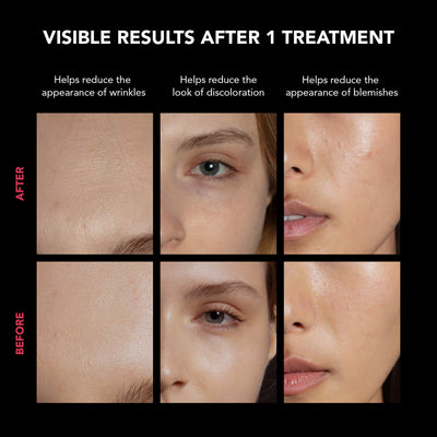 Maschera in Silicone  FAQ™ 202