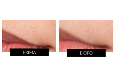 Dispositivo di Epilazione IPL & Antietà Ulike Rose