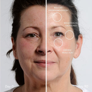 NIRA Pro Laser & Siero Avanzato