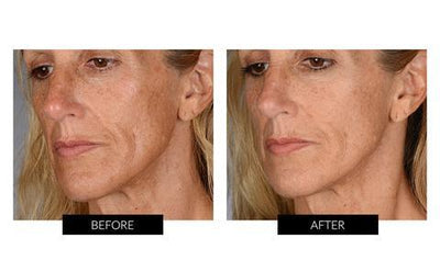 BeautyBio Face + Hair Power Duo (del valore di 380€)