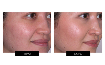 Trophy Skin Microderm MD